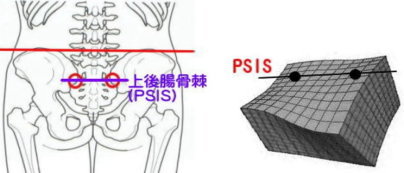 上後腸骨棘のイラスト