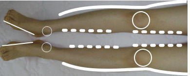 理学療法評価法 検査1