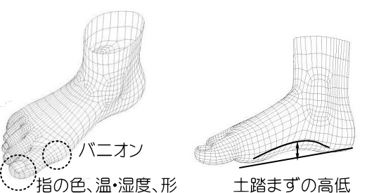 足の観察ポイント