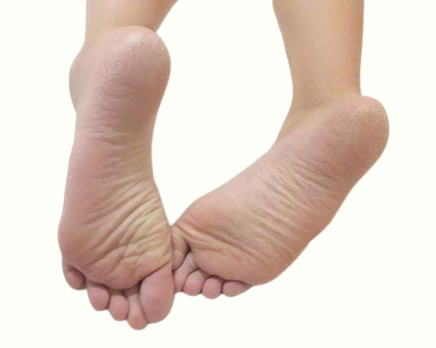 骨盤のゆがんだ足の形