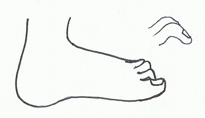 足の形と病気について
