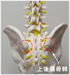 上後腸骨棘の模型写真