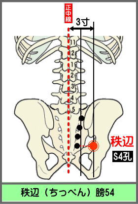 ツボ　ちっぺん